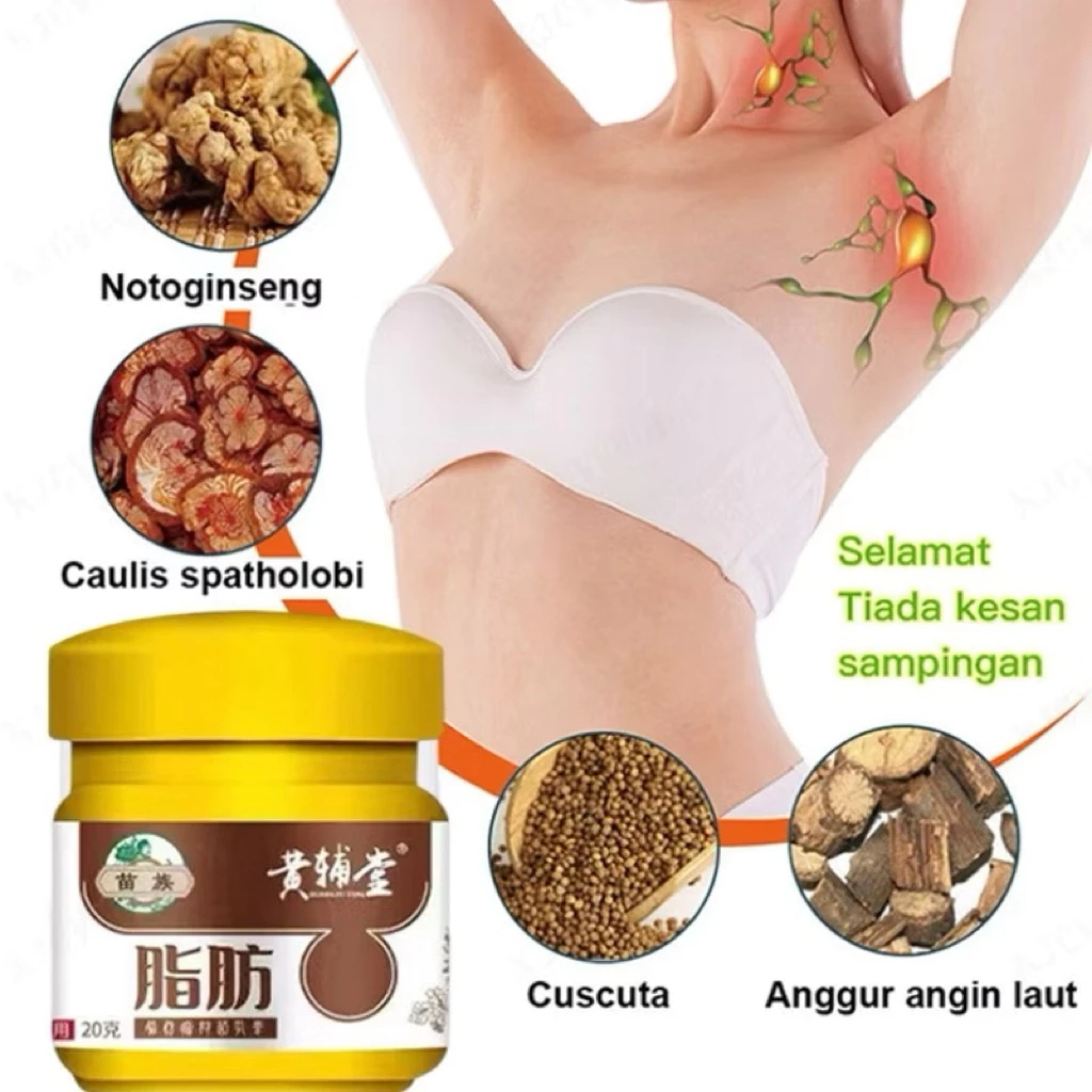 benjolan payudara Penghilang Lemak remov Lipoma Cream  Original salep lipoma salep benjolan Obat Ben