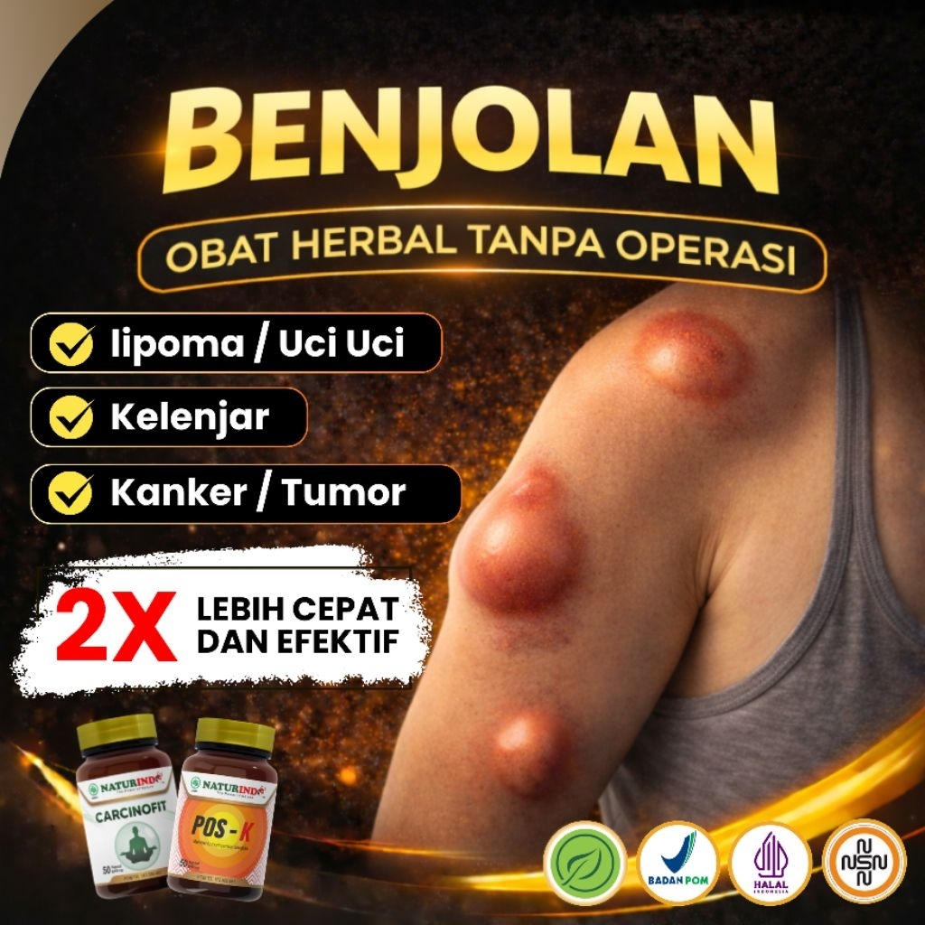 Obat Benjolan Herbal Lipoma Payudara Kelenjar Leher Ketiak