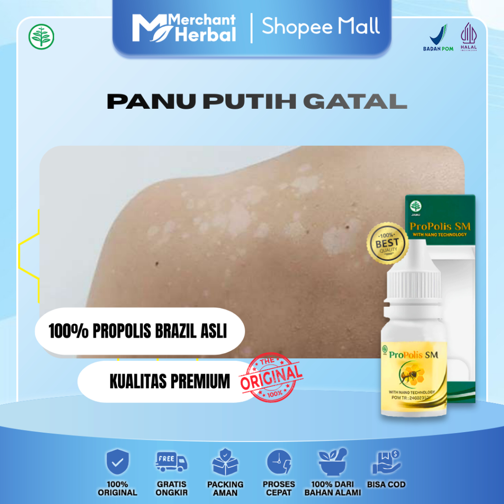 PANU PUTIH GATAL DI LEHER & DADA – Propolis SM