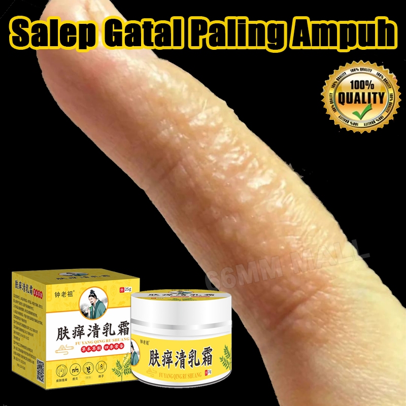 Salep Eksim Kering dan Gatal Salep Gatal China Paling Ampuh Bayi Salep Selangkangan Eksim Dan Jamur 
