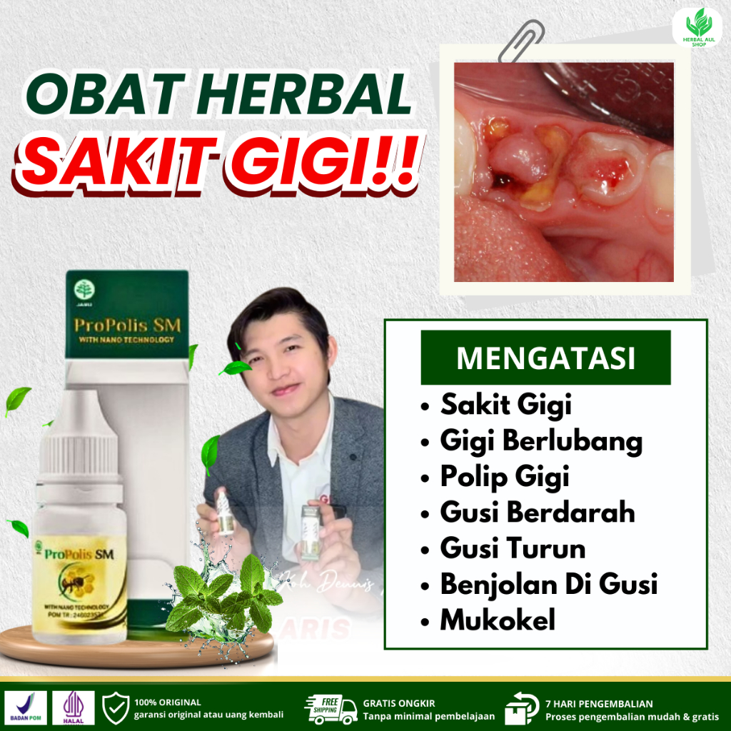Obat Untuk Sakit Gigi, Gigi Sensitif, Gigi Berlubang, Polip Gigi, Gusi Bengkak, Gusi Berdarah, Gusi 