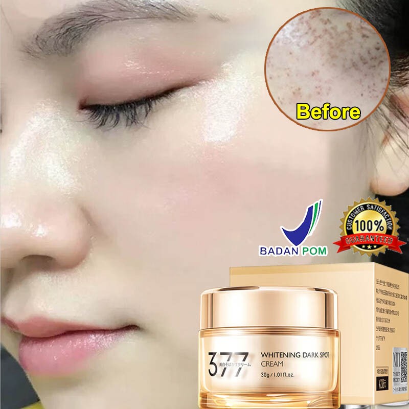 377 cream flek hitam membandel Cream penghilang flek hitam Dark spot serum Menghilangkan flek hitam 