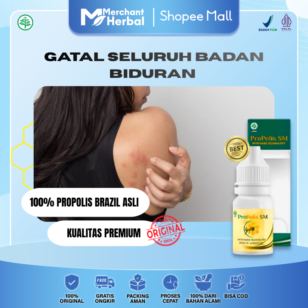 GATAL PARAH SELURUH BADAN, ALERGI & BIDURAN MENAHUN – Propolis SM