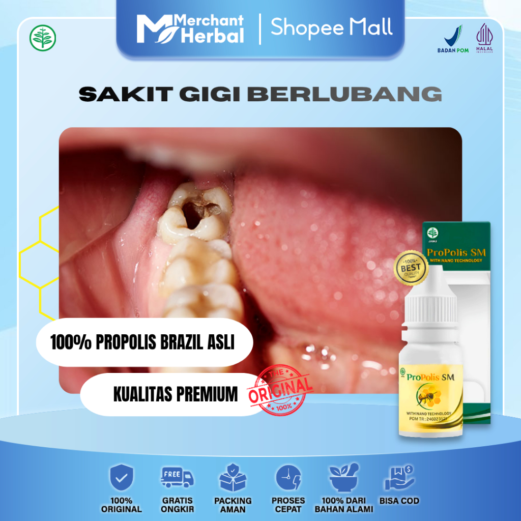 SAKIT GIGI BERLUBANG NYUT-NYUTAN & BERNANAH – Propolis SM