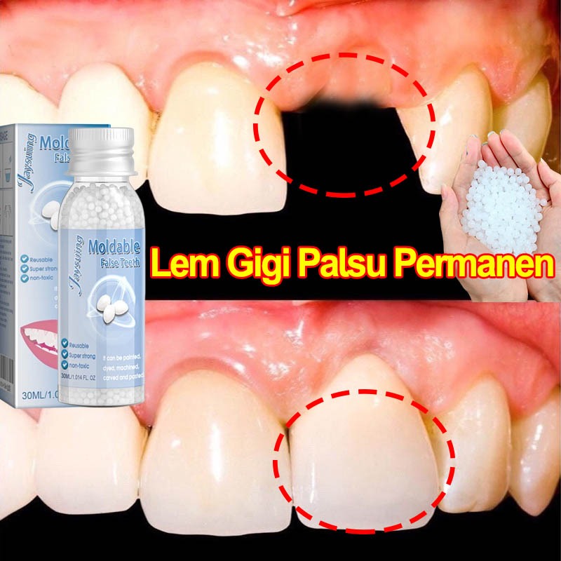Lem Gigi Palsu Permanen 30ml Penambal gigi berlubang Lem Gigi Palsu Permanen Instan Perbaiki Gigi Pa