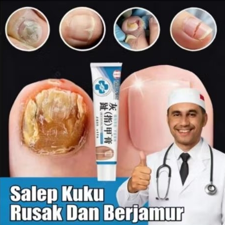 salep kuku rusak dan berjamur