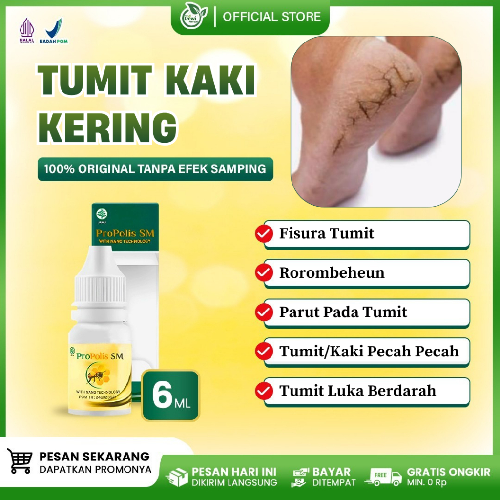 Obat Kaki Pecah Pecah Fisura Tumit Kering Pecah Dan Luka Berdarah Kaki Tumit Kasar Rorombeheun Parut