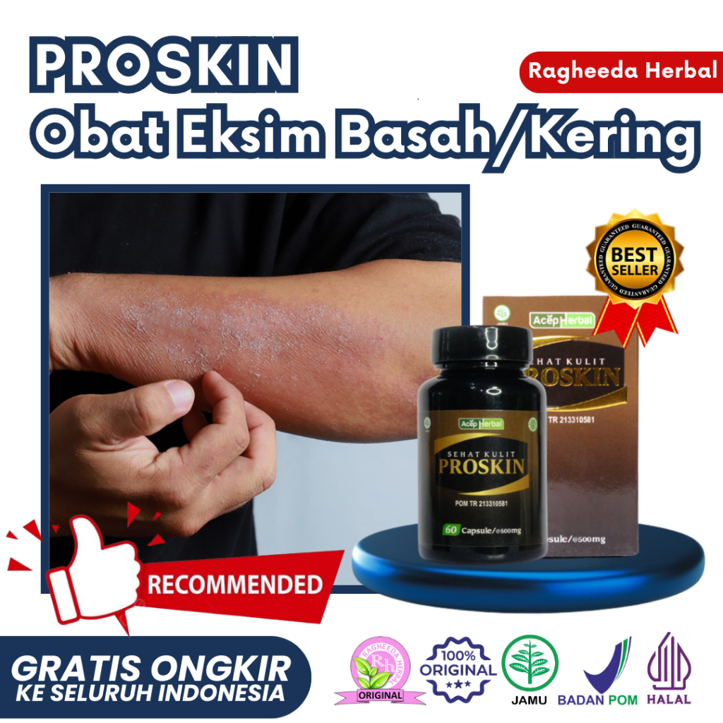 Obat Eksim Kering - Eksim Basah Bernanah, Bintil Berair di Jari Tangan, Gatal Kemerahan di Selangkan