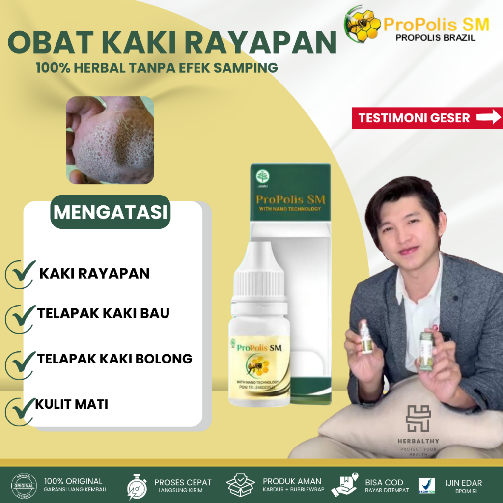 Obat Kaki Rayapan Herbal, Obat Kaki Rayapan dan Bau, Obat Penghilang Kaki Rayapan, Obat herbal Telap