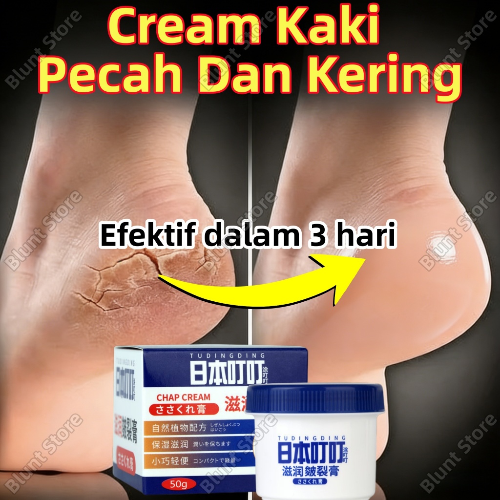 Cream Kaki Pecah Dan Kering Foot Cream Obat Kaki Pecah Pelembab Kaki Foot Cream Penghalus Kaki Kasar