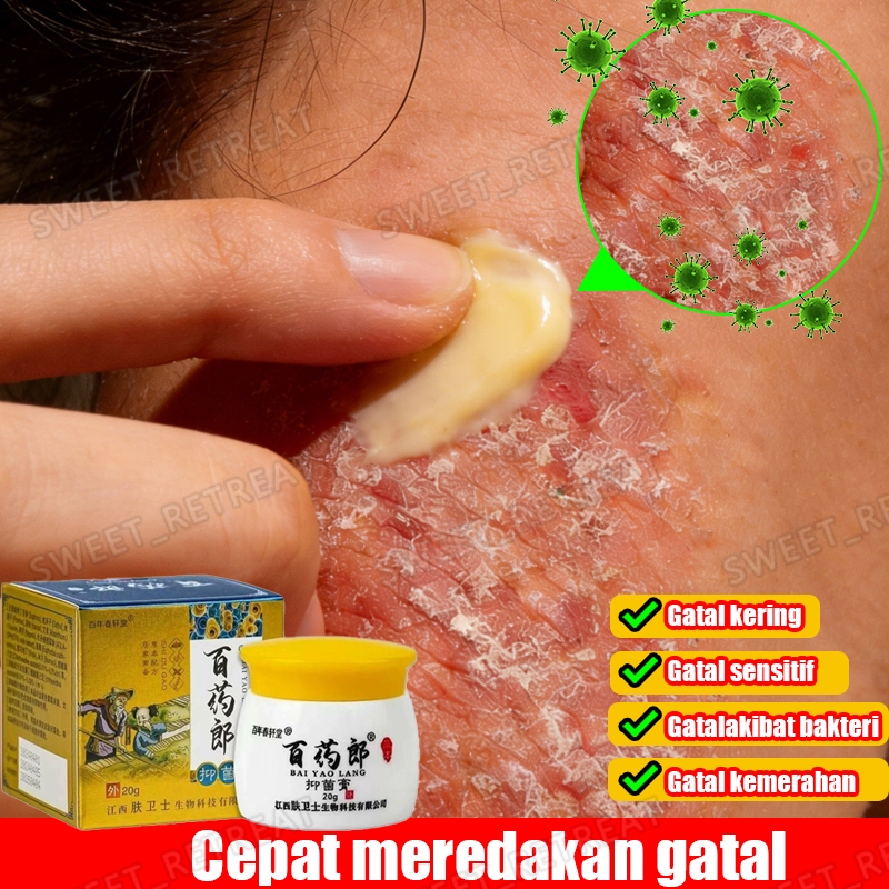 Salap gatal china salep eksim kering dan gatal salep gatal di selangkangan oba gatal kulit salep chi