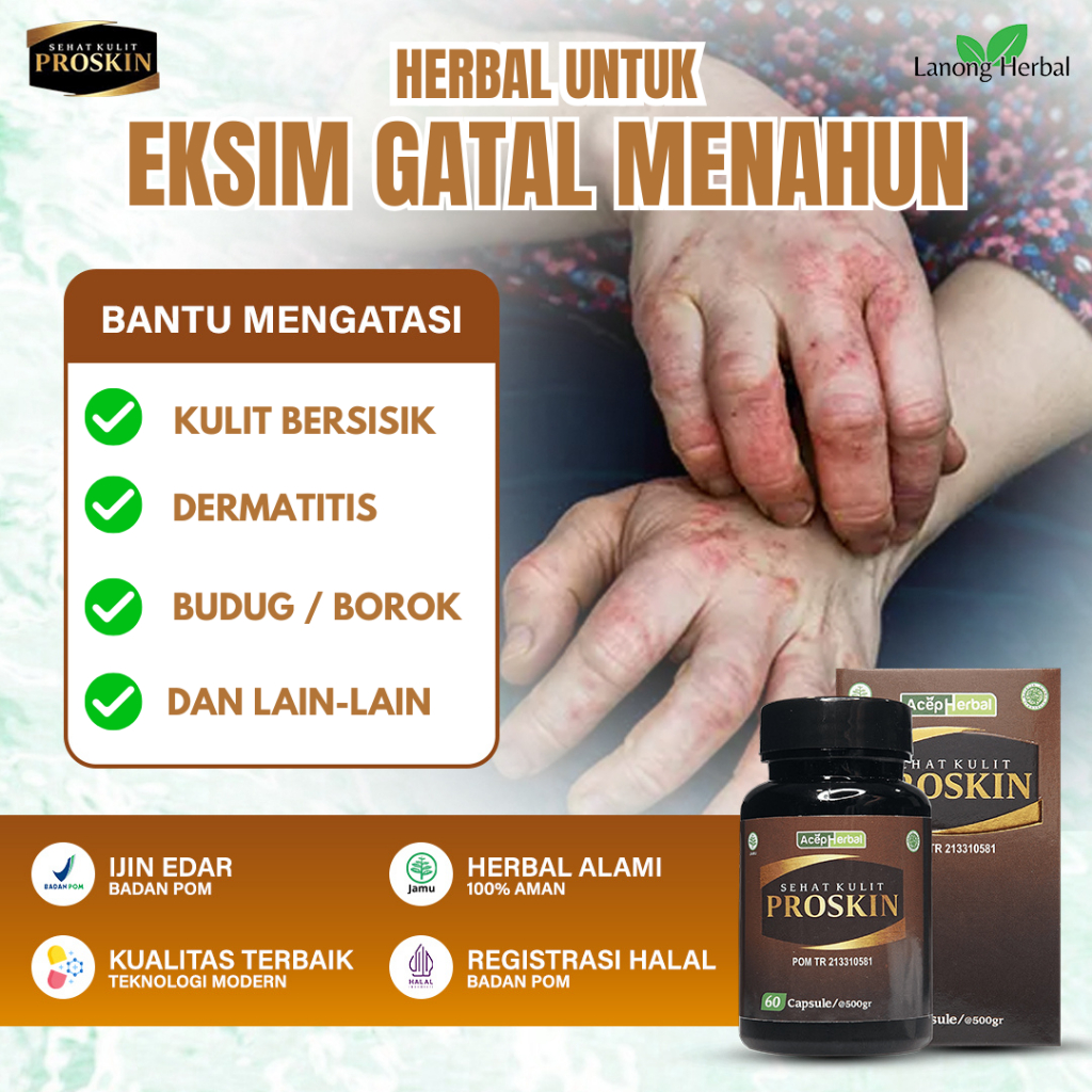 PROSKIN Obat Eksim Gatal Menahun Eksim Kering (Dermatitis Atopik) Eksim Basah Psoriasis (Kulit bersi