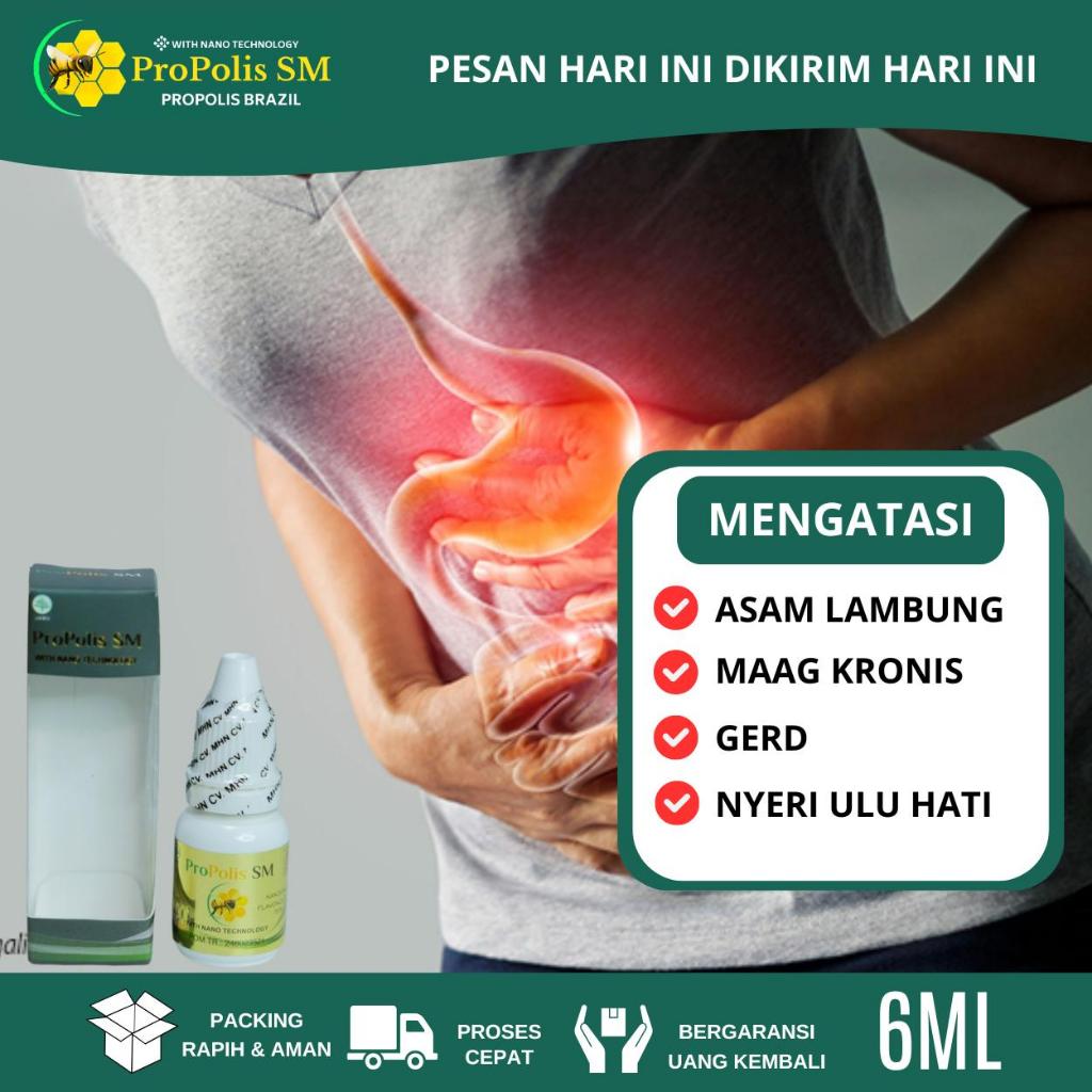 Obat Asam Lambung, Maag, Asam Lambung Naik, Gerd, Asam Lambung Kronis, Penurun Asam Lambung, Nyeri U