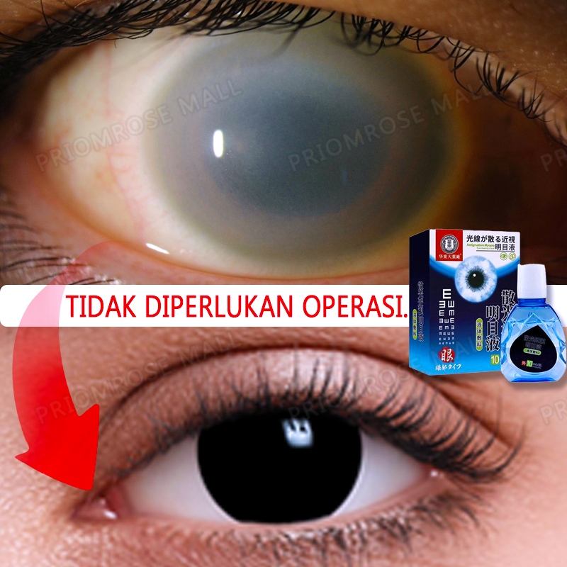 Tetes Mata Eye Drop  Mata Katarak  Mata Buram  Mata Berlemak Tetes Mata  Mata Kering Mata Merah Saki