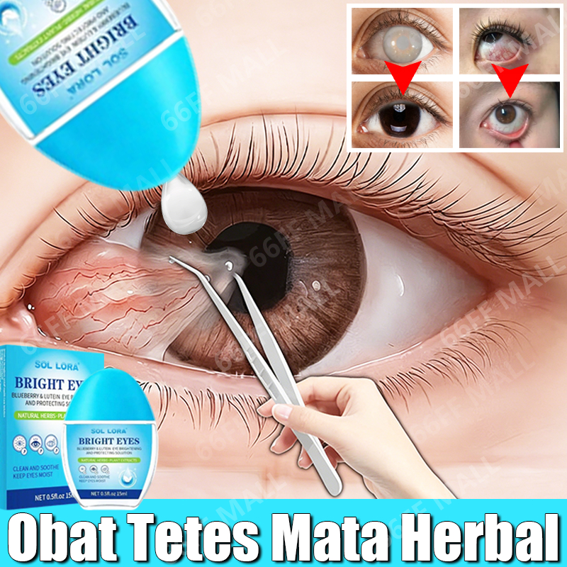 obat tetes mata katarak 15ml tetes mata minus paling ampuh obat mata katarak dan buram eye drop tete