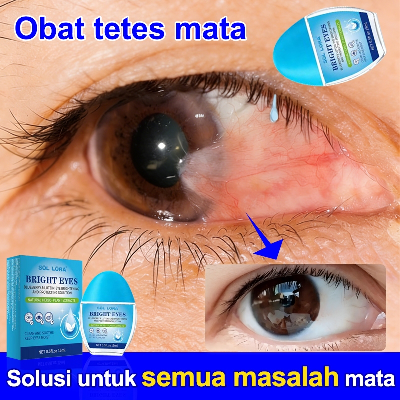 Obat Tetes Mata Katarak Mata Obattetes Mata Ampuh Katarak Minus Paling Ampuh Obat Sakit Mata Tetes M
