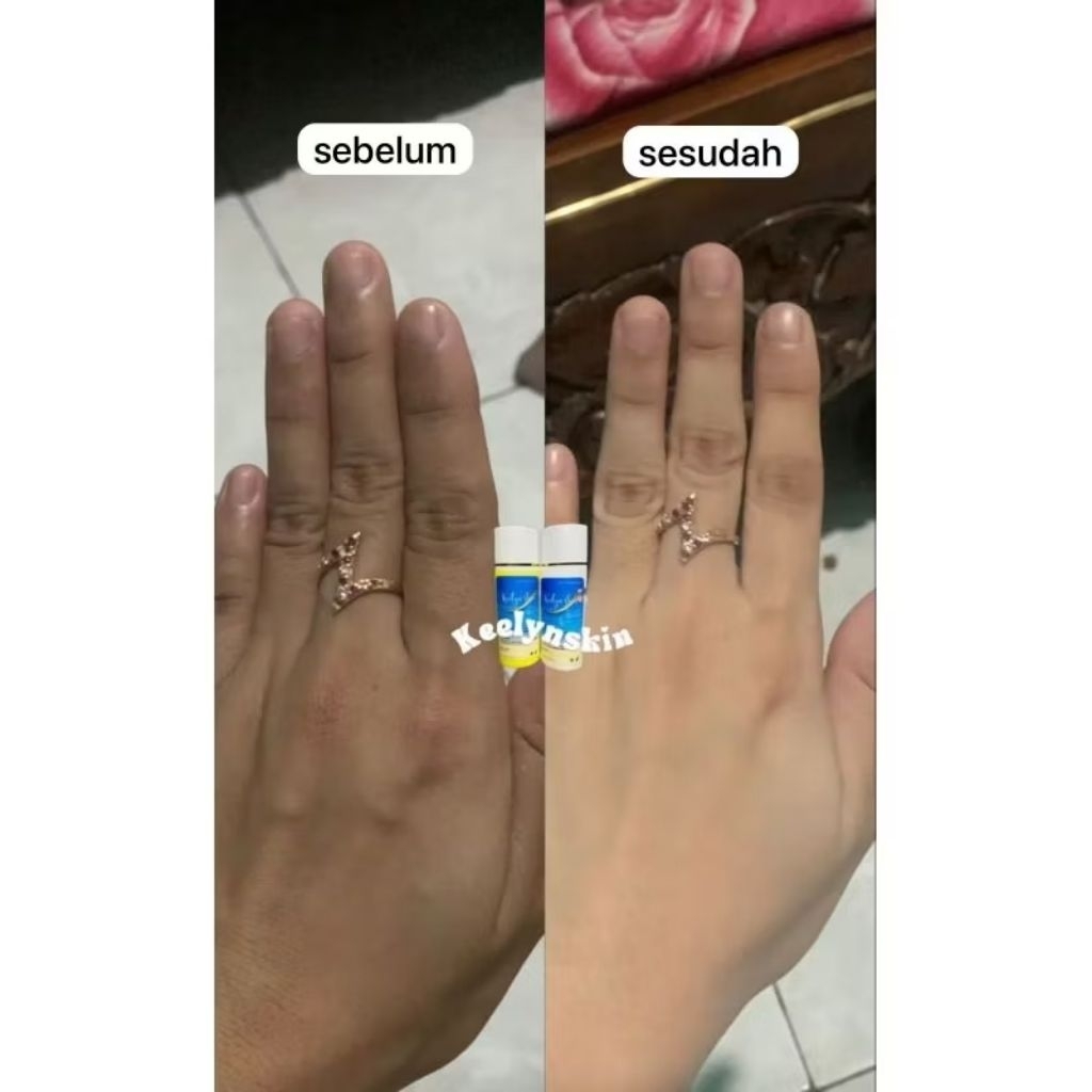 1 Paket HB KEELYNSKIN siang malam / Hb dosting BPOM pencerah kulit /2x lebih cepat putih best seller