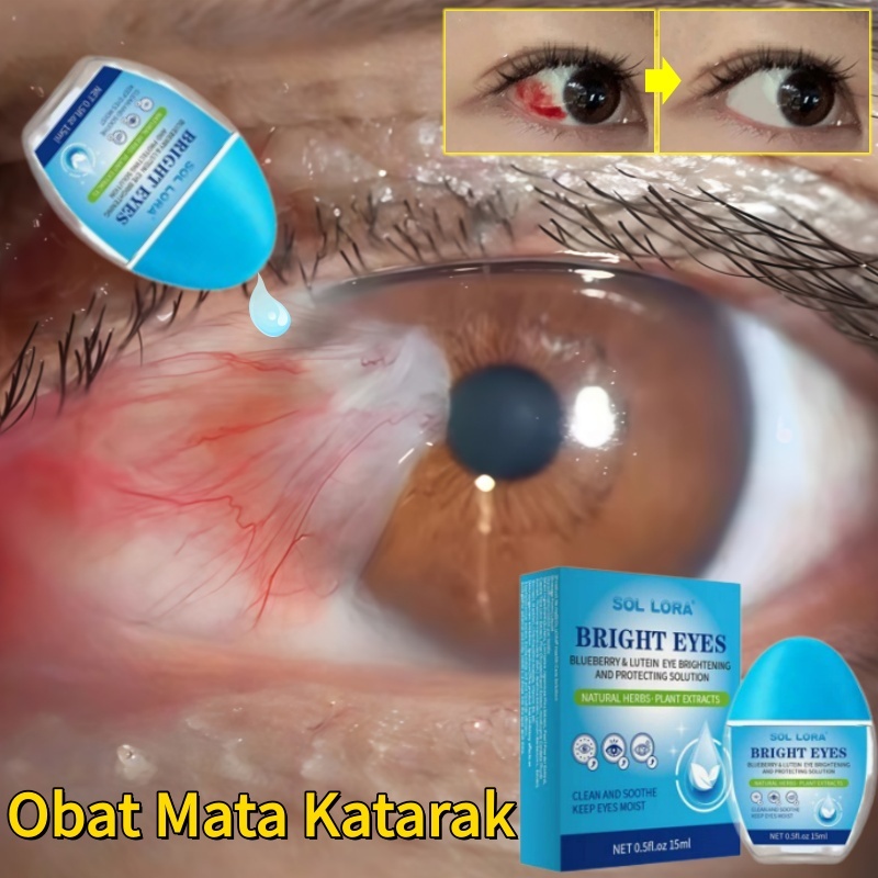 Tetes mata katarak Tetes mata kering Tetes mata buram paling ampuh Tetes mata minus Meningkatkan Pen