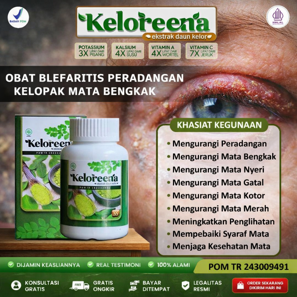 Obat Blefaritis - Peradangan Kelopak Mata - Kelopak Mata Bengkak - Mata Bintitan | KELOREENA Kapsul