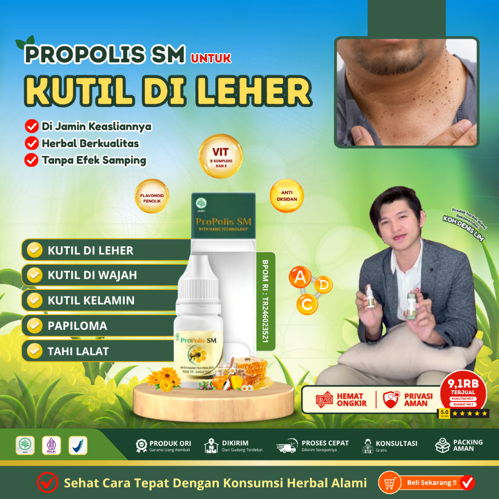 Penghilang kutil di leher, Papiloma di leher, Perontok Kutil - Perontok Papiloma di Leher - Obat Per