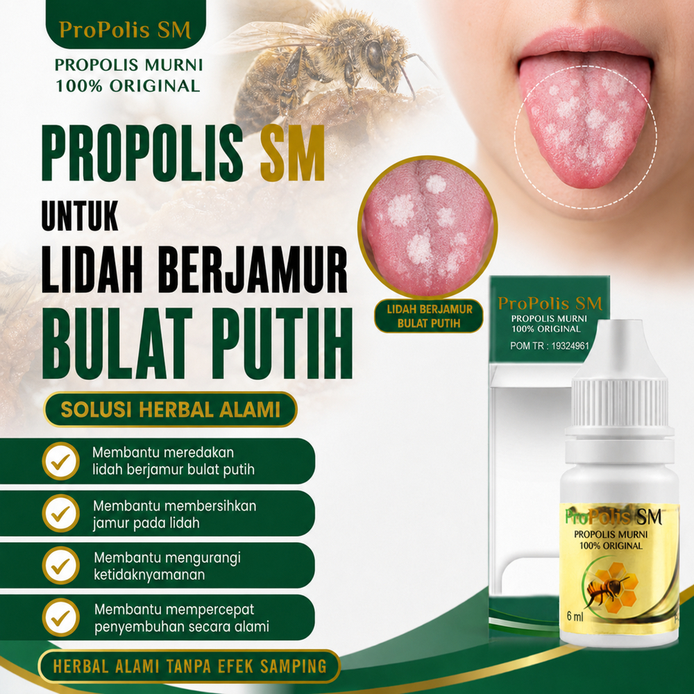 Obat Radang Lidah,Lidah Terasa Pahit,Luka Di Lidah,Sariawan Di Lidah,Kanker Lidah,ProPolis SM