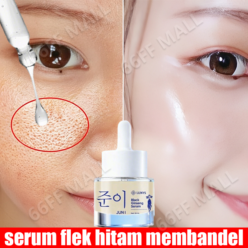 serum flek hitam membandel serum dark spot paling ampuh penghilang flek hitam di wajah serum wajah f