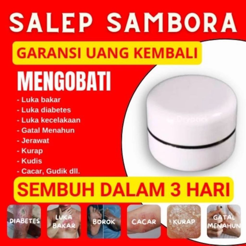 ALL IN ONE SALEP KULIT LUKA DIABETES LUKA BAKAR LUKA AIR PANAS | SALEP GATAL GATAL LEHER | SALEP RAC