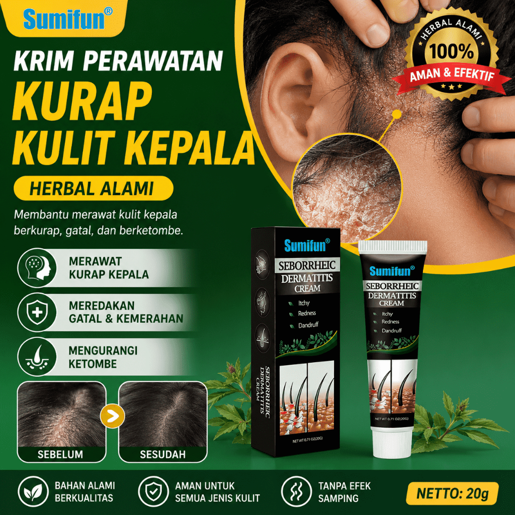 OBAT KETOMBE PARAH Krim Anti Gatal untuk Ketombe Parah Psoriasis dan Dermatitis Seboroik di Kulit Ke