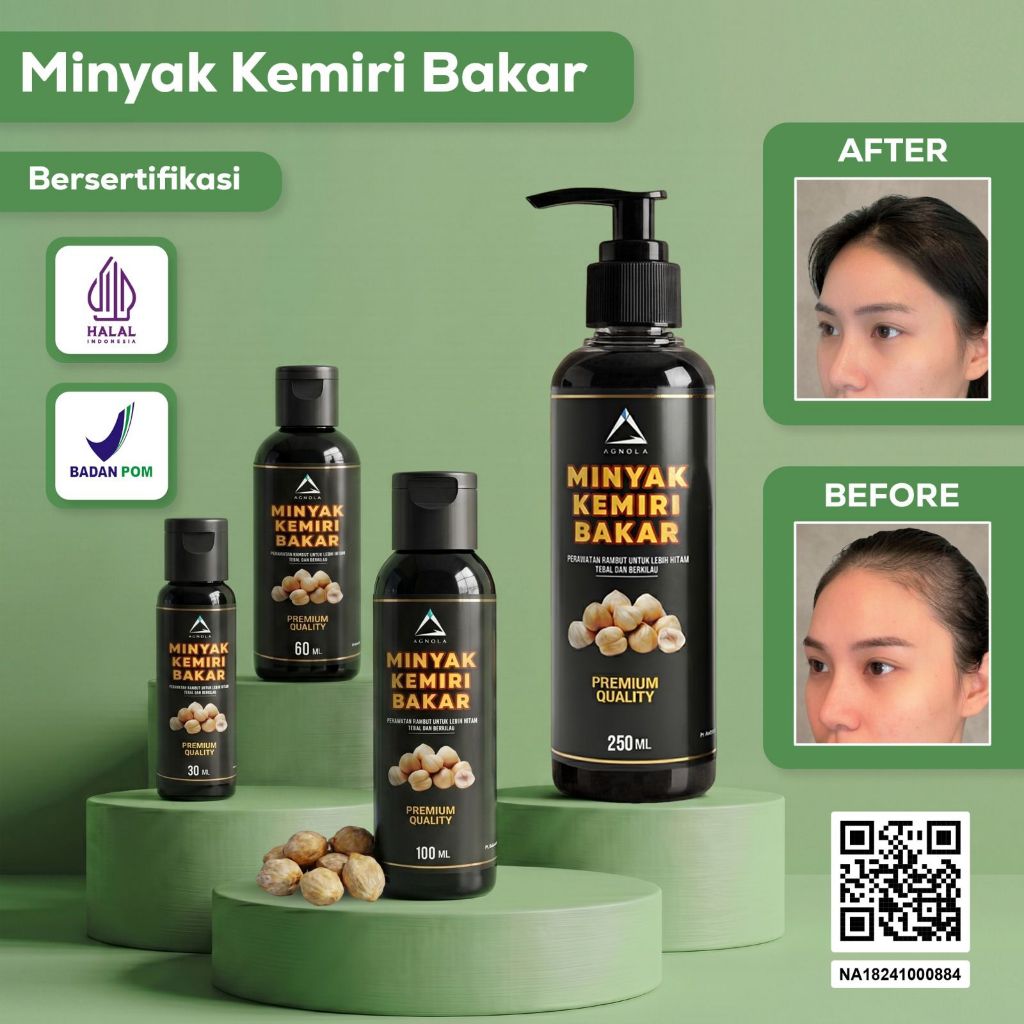 [BPOM & HALAL] Minyak Kemiri Bakar 100% Asli Penumbuh Rambut Bayi Dan Dewasa 30ml TERLARIS