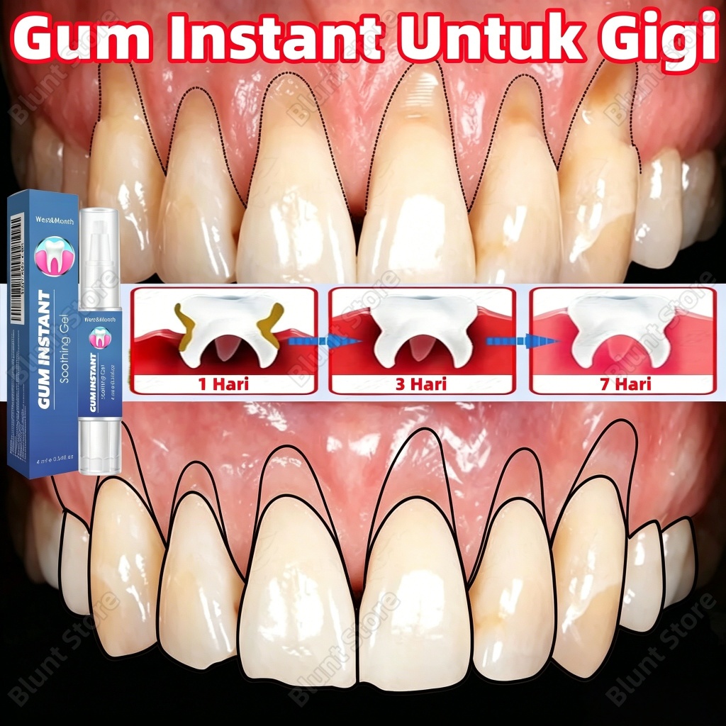 Penguat Gigi Goyang Gum Instant Untuk Gigi Obat Penghilang Gusi Bengkak Gum Care Gel Tambal Gigi Gel