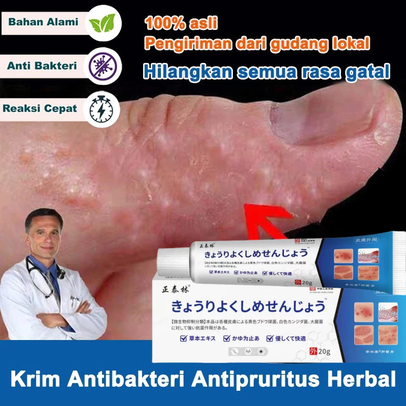 Salep Khusus Psoriasis Obat Gatal Eksim Krim psoriasis paling ampuh Kulit Kepala Psoriasis Tangan Ti