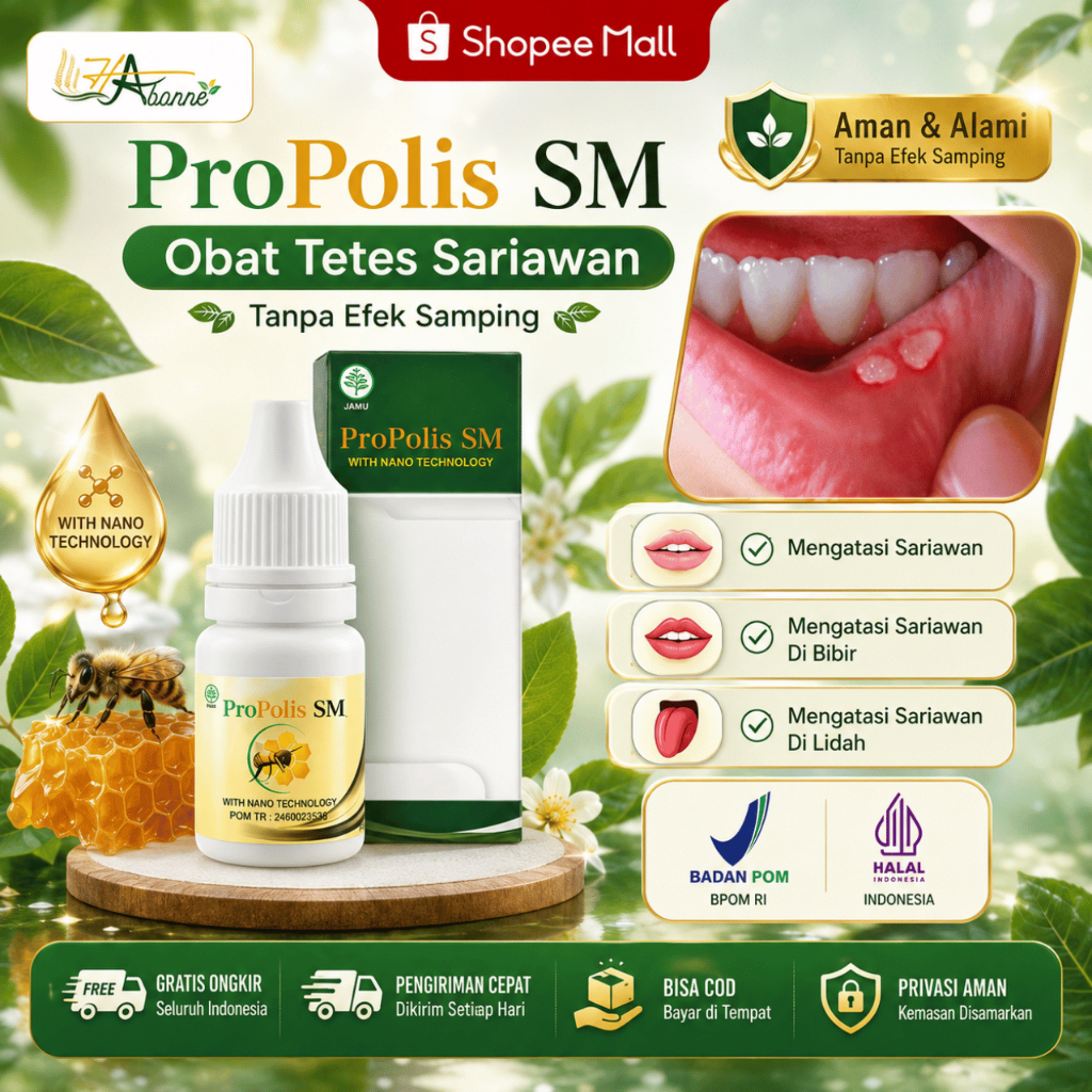 Obat Sariawan, Obat Sariawan Mulut, Obat Sariawan Anak, Obat Sariawan Lidah Dewasa, Obat Sariawan di