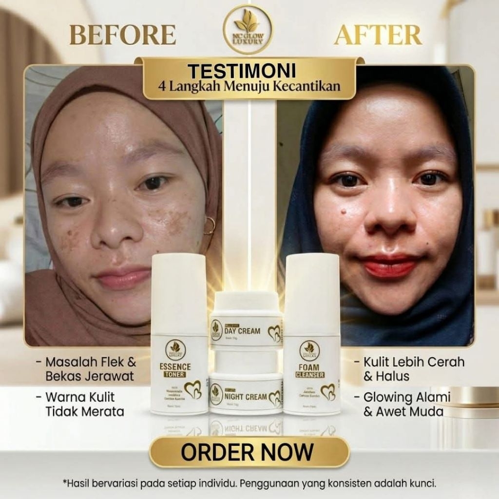 cream flek nc glow luxury BPOM