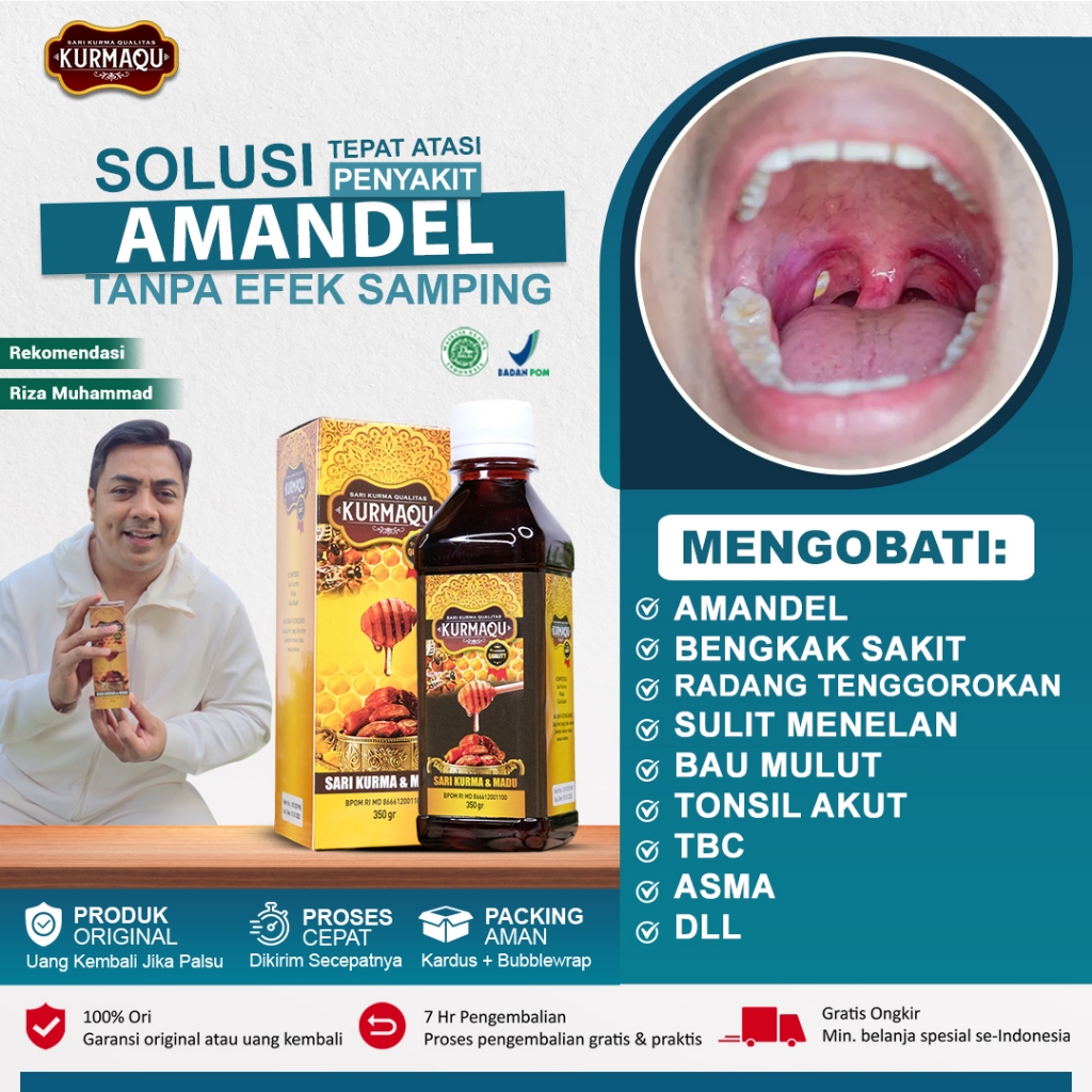 Obat Herbal Amandel Anak dan Dewasa BPOM, Obat Amandel Bengkak, Obat Radang Amandel, Obat Nyeri Teng