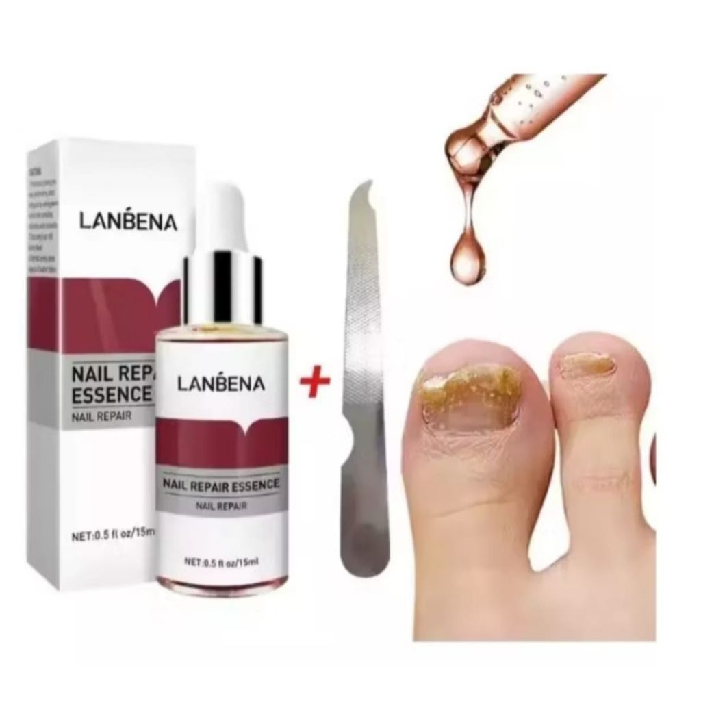 SERUM KUKU LANBENA ANTI JAMUR PERAWATAN KUKU RUSAK