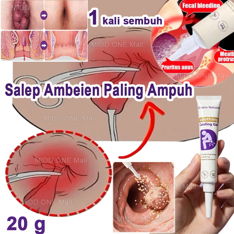 Salep Ambeien Paling Ampuh Obatwasir Benjolan Luar Salep Wasir Untuk Benjolan Nature Gel Wasir Herba