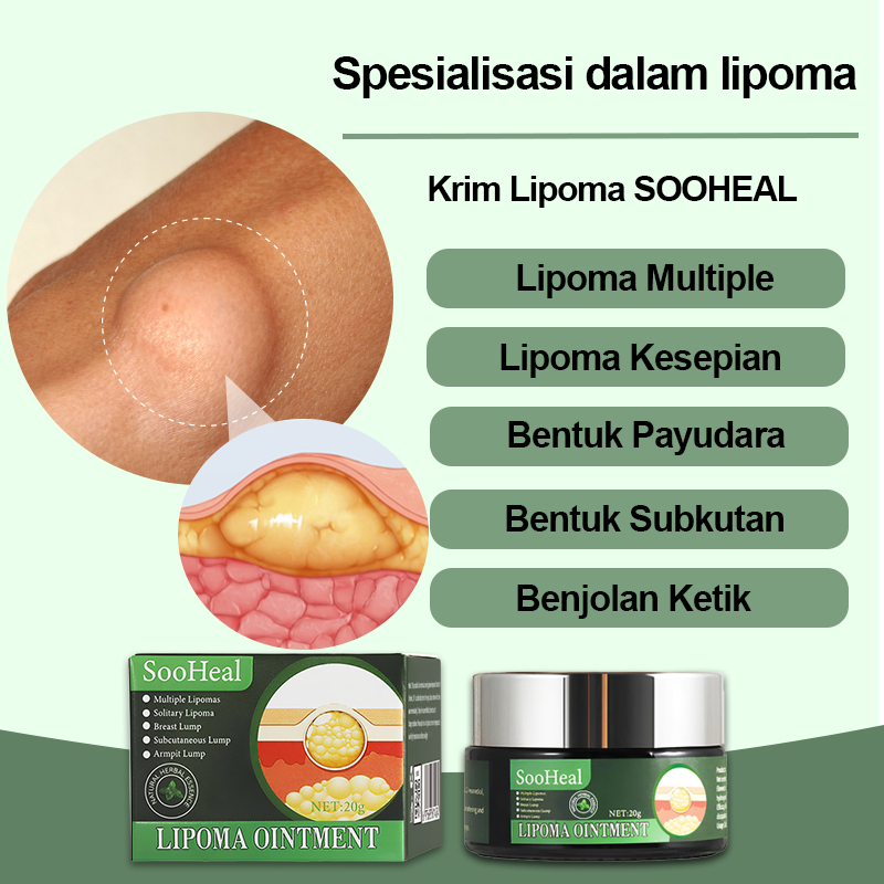 Krim Lipoma,Salep Lipoma,Lipoma Cream,15g,Salep benjolan lipoma ampuh,Salep penghilang benjolan lema