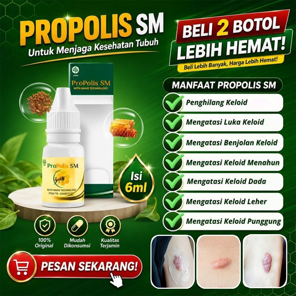 Propolis SM Asli 100% Original Obat Herbal Atasi  Keloid Di Dada. Keloid Menahun, Penghilang Keloid,