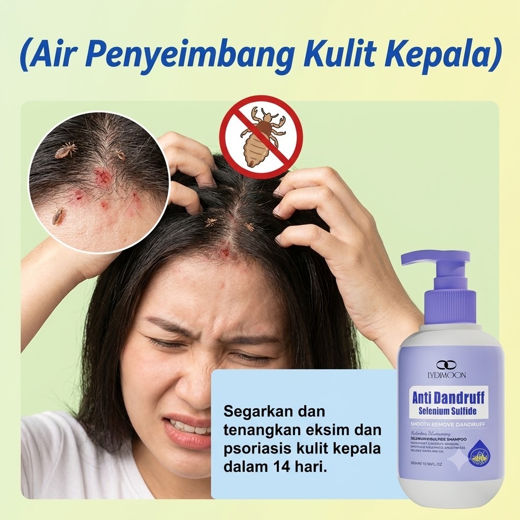 Shampo Kutu Rambut Anak dan 300ml Anti Ketombe dan Mengatasi Rambut Rontok