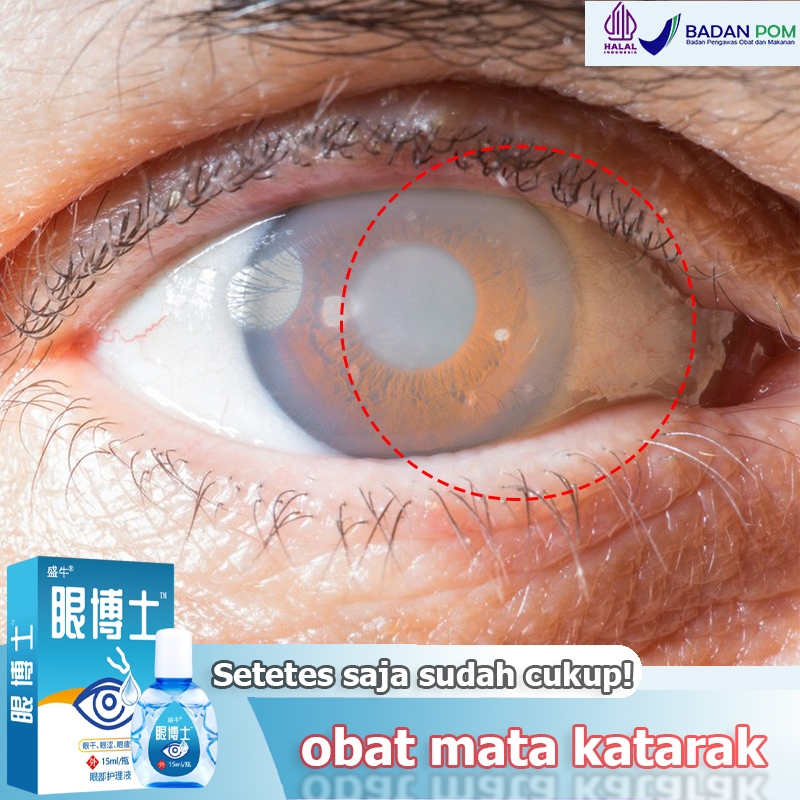 Obat mata katarak Obat mata minus Obat tetes mata Tetes mata 15ml Obat mata Obat katarak Obat tetes 