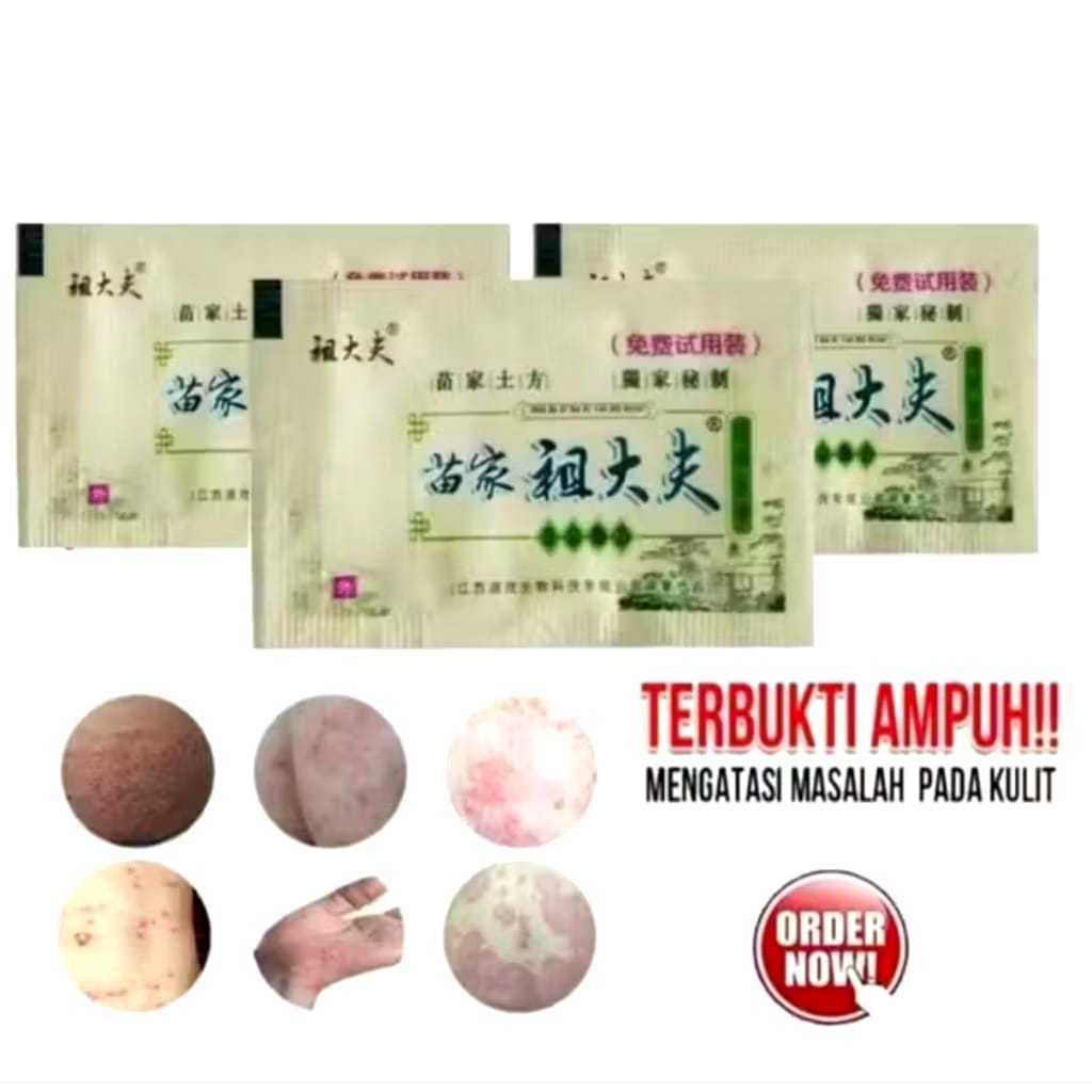 ZUDAIFU Sachet Salep Kulit Ampuh Mengatasi Alergi Eksim Kudis Panu 2g Original
