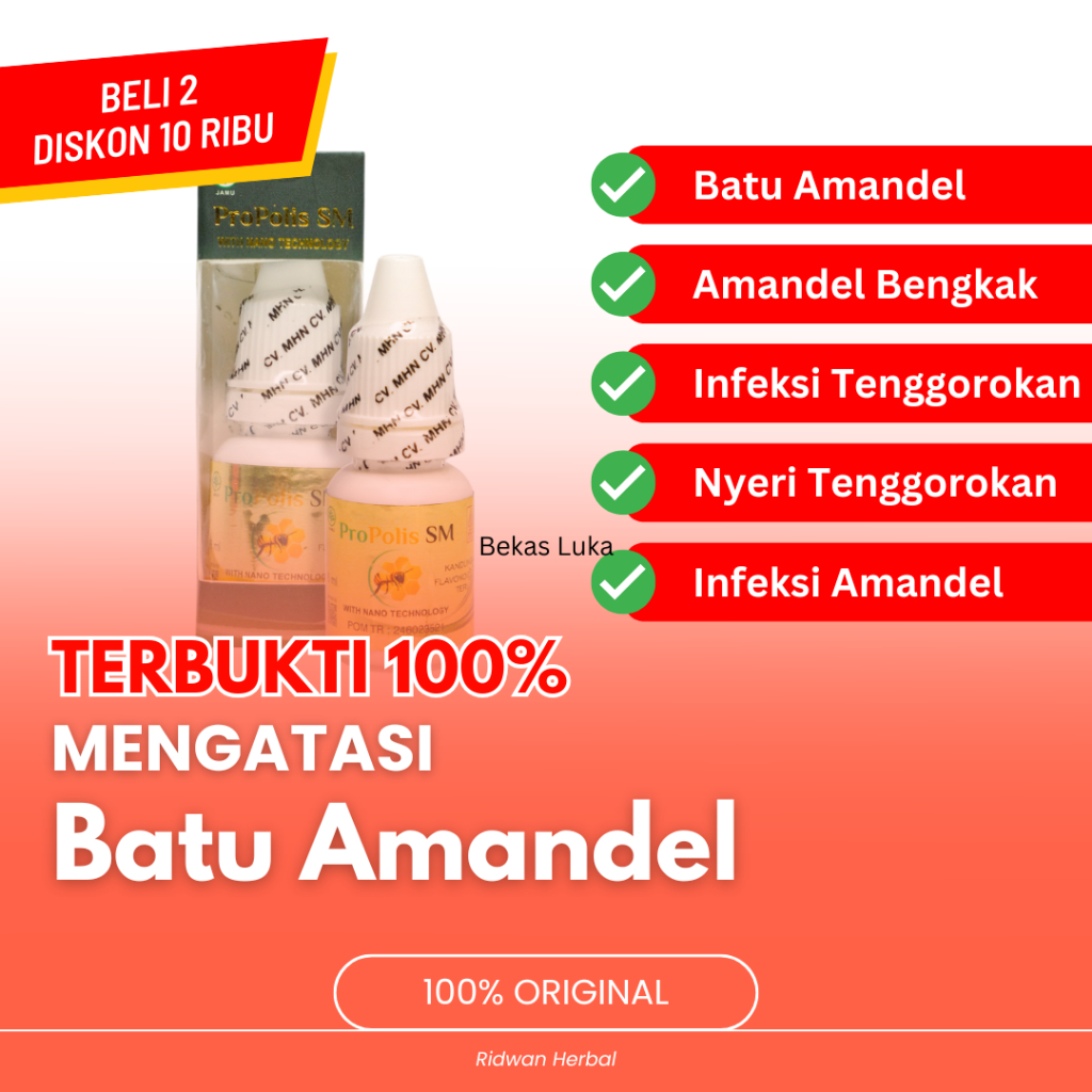 Obat Batu Amandel, Obat Amandel Bengkak, Obat Infeksi Tenggorokan, Obat Nyeri Tenggorokan, Obat Infe