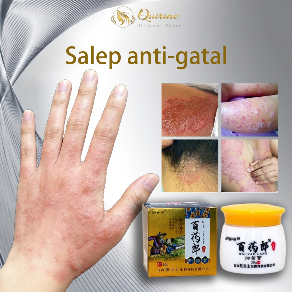 Quirino salep gatal paling ampuh Anti jamur salep gatal selangkangan pada salep selangkangan gatal d