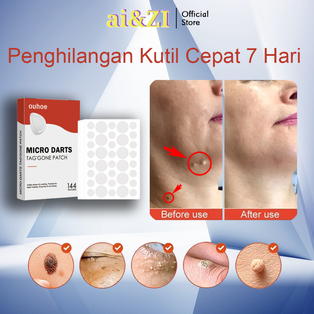 AI&ZI Sticker penghilang kutil 144pcs/kotak dan tahi lalat Penghilang Tahi Lalat Di Wajah kutil remo