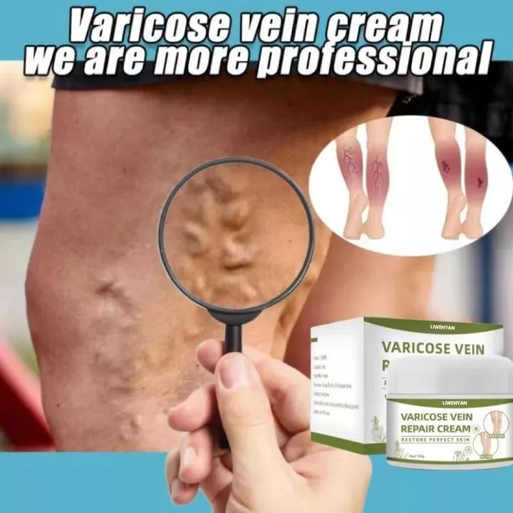 Krim Penghilang Varises Liwenyan Varicose Venis Cream 50g   Krim Efektif Penghilang Varises Di Kaki 