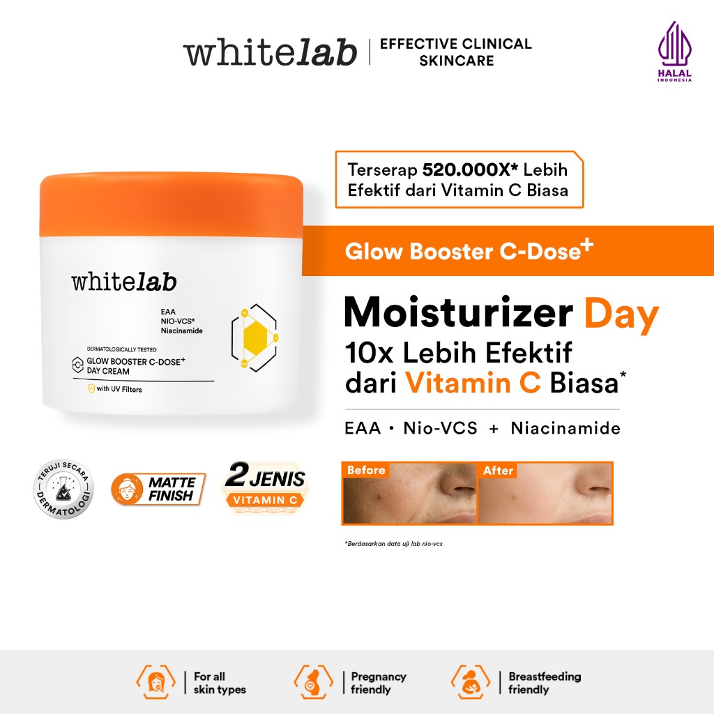 Whitelab Glow Booster C-Dose+ Day Cream - Pelembap Krim Pagi Pencerah Wajah untuk Kulit Kering denga