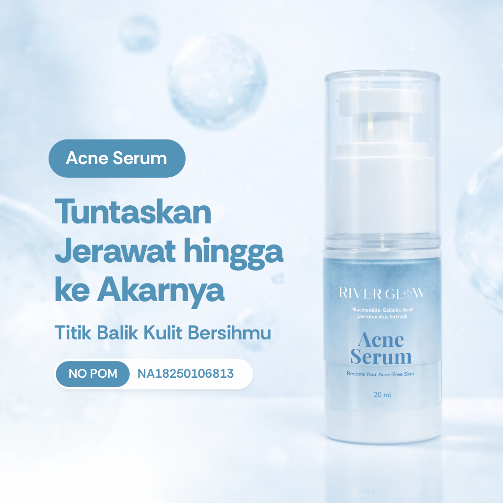 RIVERGLOW Acne Serum - Serum Jerawat Menghilangkan Jerawat Bekas Jerawat Bruntusan Wajah Pria Wanita
