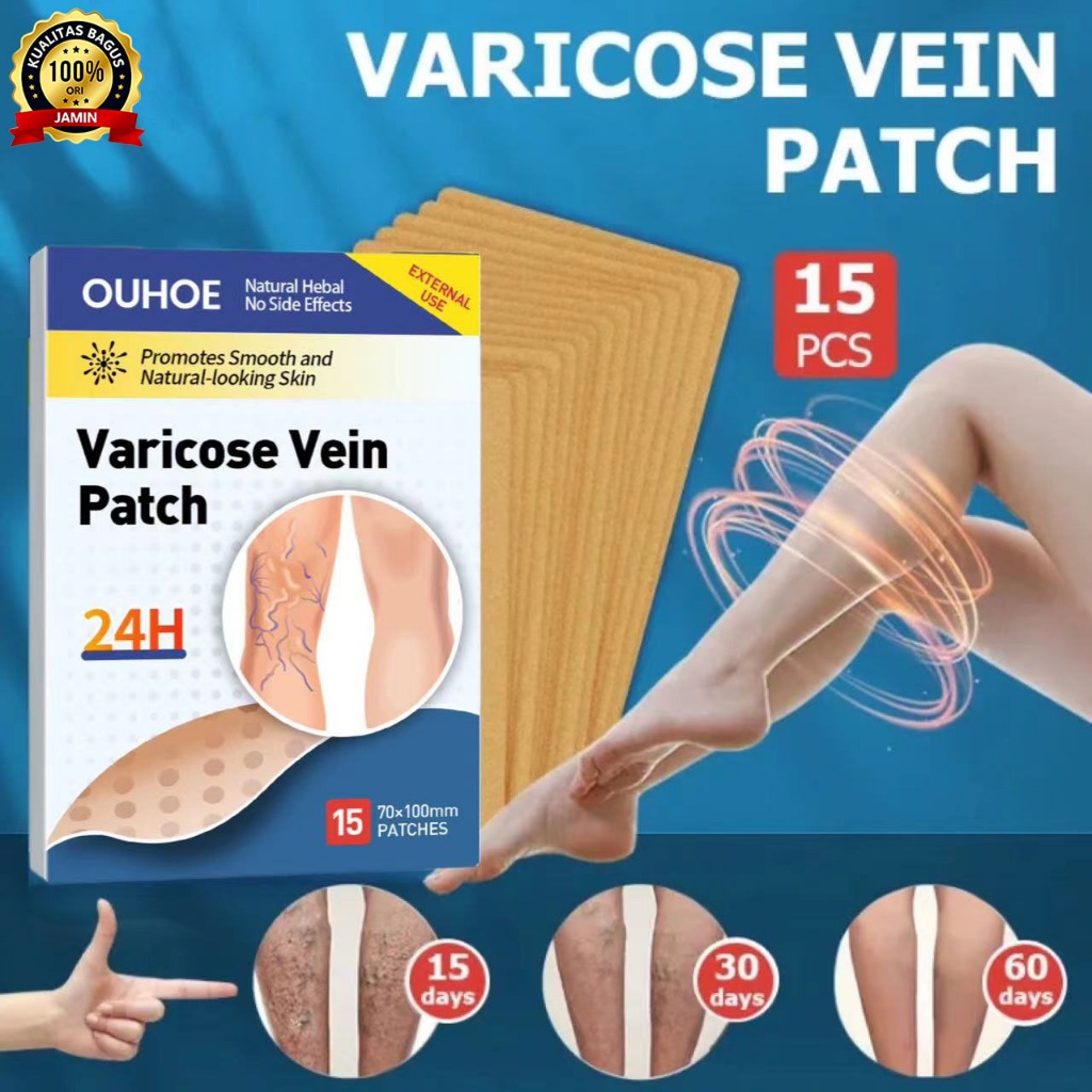 OUHOE Koyo Varises Penghilang Varises Di Kaki Varicose Patch Obat Varises Herbal Koyo Varicose 15pcs