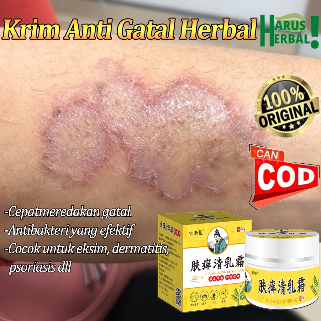 Salep Cina Gatal Paling Ampuh Salep gatal jamur selangkanga Krim Eksim Salep miss v gatal Krim Gatal