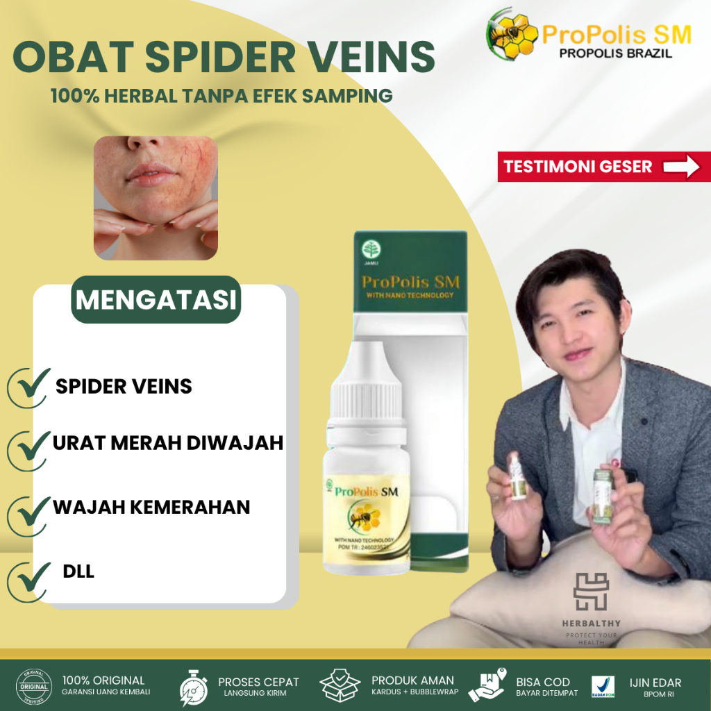 PROPOLIS SM 100% ORIGINAL BPOM, Obat Herbal Anti Spider Vein, Obat tetes Untuk Spider Vein Original 